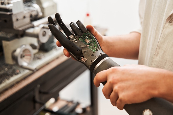 Man holding bionic hand while developing prothesis artificial limbs